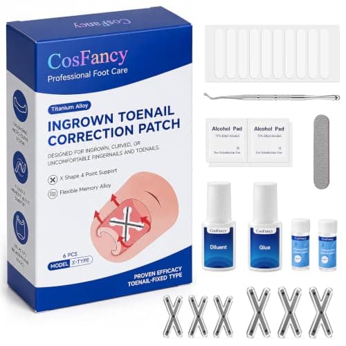 Ingrown Toenail Treatment Kit - Upgraded X-Type Titanium Alloy Corrector | Ingrown Toenail Removal Kit Designed for Curved Nail Repair and Ingrown Toenail Corrector for Big Toe Relief